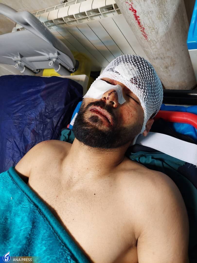 سامان فلاح به دلیل تصادف راهی بیمارستان شد+عکس سامان فلاح به دلیل تصادف راهی بیمارستان شد+عکس