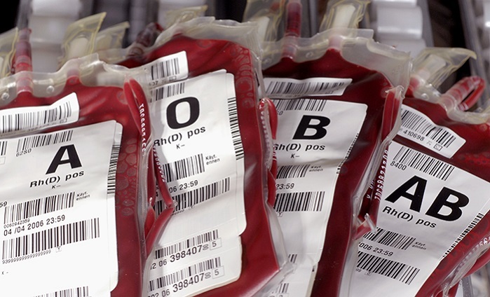 ارتباط مستقیم گروه خونی با افزایش خطر بروز سکته مغزی زودهنگام