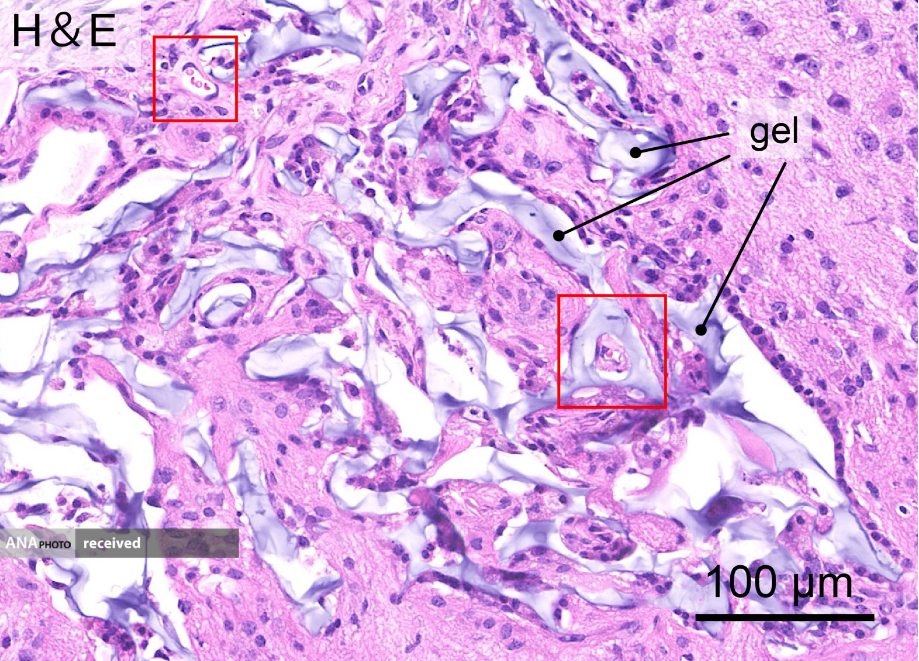 شفای مغز: هیدروژل ها رشد بافت عصبی را امکان پذیر می کنند شفای مغز: هیدروژل ها رشد بافت عصبی را امکان پذیر می کنند