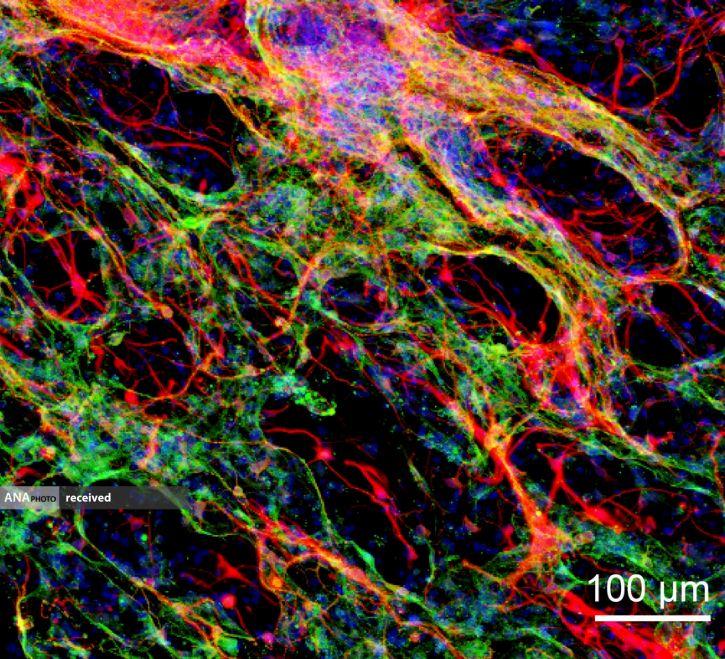 شفای مغز: هیدروژل ها رشد بافت عصبی را امکان پذیر می کنند