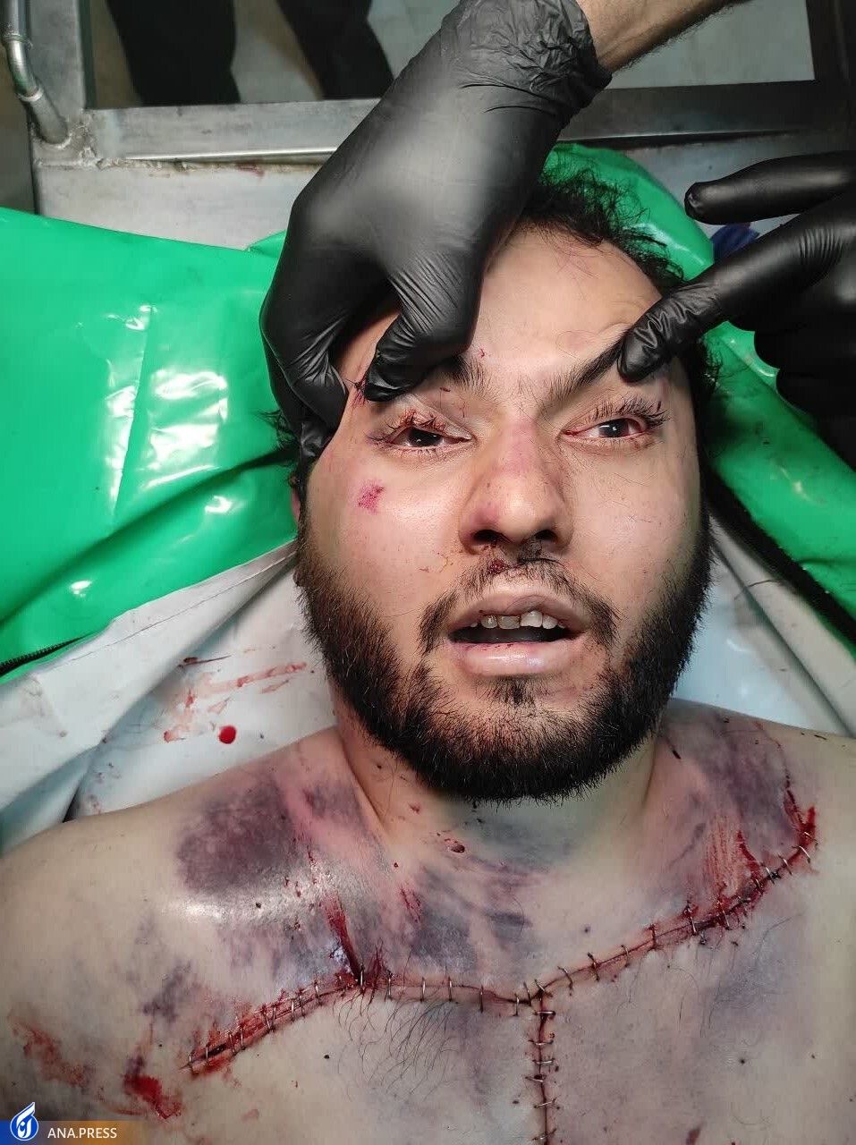 عامل تکفیری حادثه تروریستی شیراز به درک واصل شد عامل تکفیری حادثه تروریستی شیراز به درک واصل شد