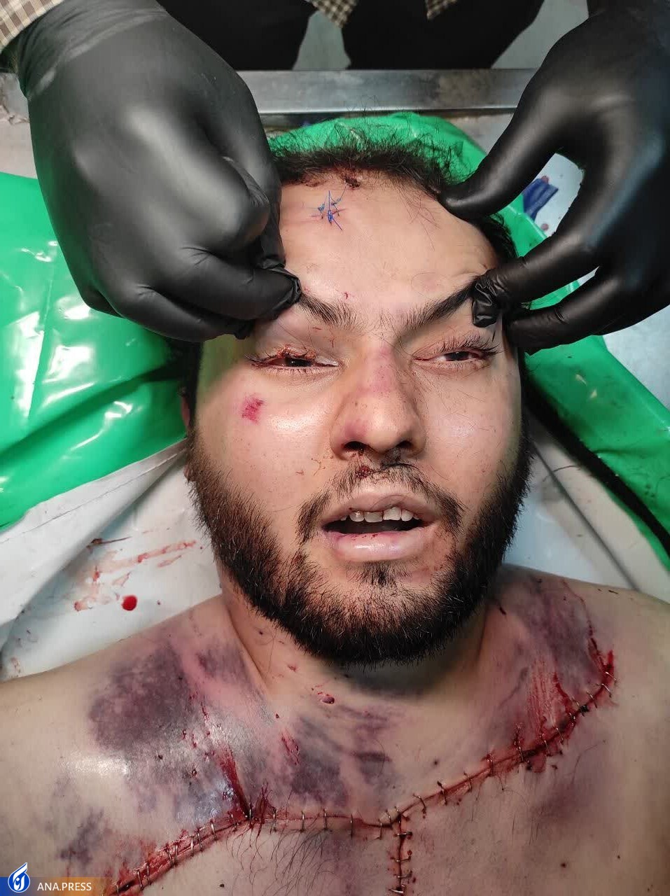 عامل تکفیری حادثه تروریستی شیراز به درک واصل شد عامل تکفیری حادثه تروریستی شیراز به درک واصل شد