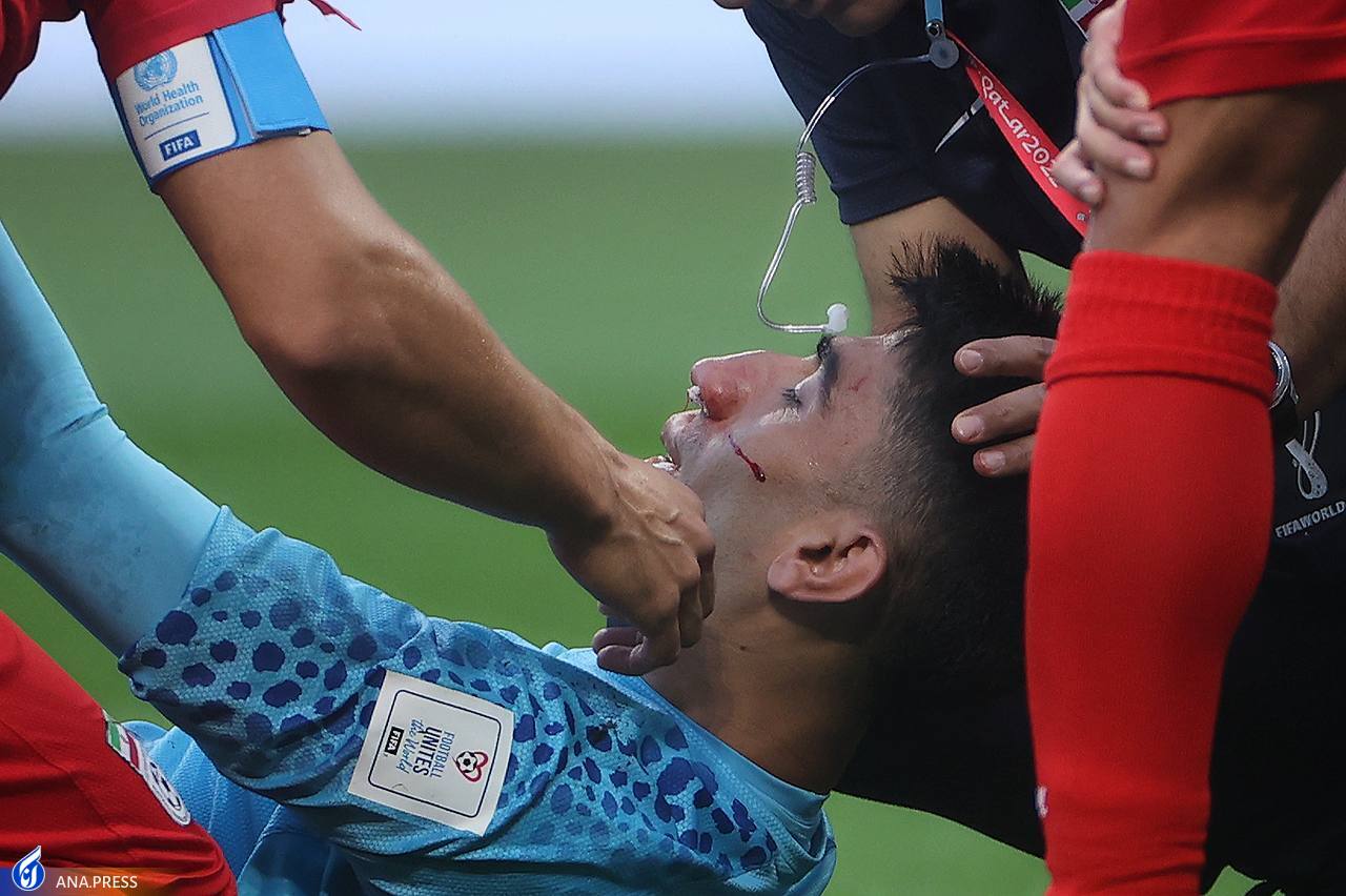 بحث داغ در دوحه؛ اشتباه فاحش تیم پزشکی ایران در مورد بیرانوند! بحث داغ در دوحه؛ اشتباه فاحش تیم پزشکی ایران در مورد بیرانوند!