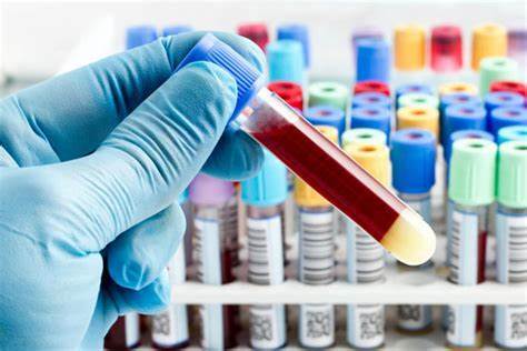 فناوری جدیدی که نجاتبخش بیماران سرطانی میشود/ تحول در غربالگری سرطان با یک انجام یک آزمایش فناوری جدیدی که نجاتبخش بیماران سرطانی میشود/ تحول در غربالگری سرطان با یک انجام یک آزمایش