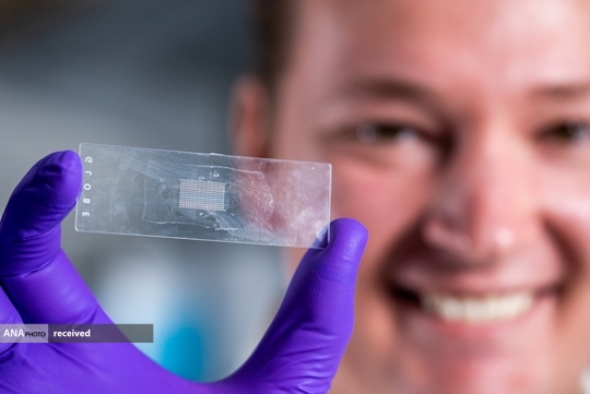 رهاسازی دارو در زمان مناسب با استفاده از فناوری پیشرفته میکروذرات رهاسازی دارو در زمان مناسب با استفاده از فناوری پیشرفته میکروذرات