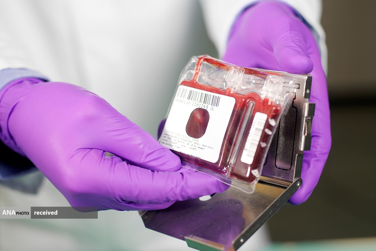 از راهاندازی اولین پالایشگاه محصولات زایمانی تا تولید زخمپوش از پردههای جنینی از راهاندازی اولین پالایشگاه محصولات زایمانی تا تولید زخمپوش از پردههای جنینی