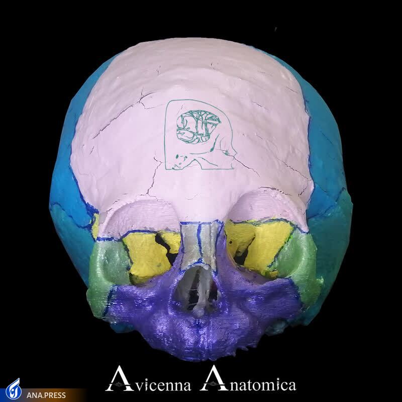 تولید محصول دانش‌بنیان «مِش تیتانیومی» که زمان جراحی و خونریزی را کاهش می‌دهد/ مشکل میکروسکوپ‌های فاقد اتصال دوربین با «میکروسرجری» رفع شد