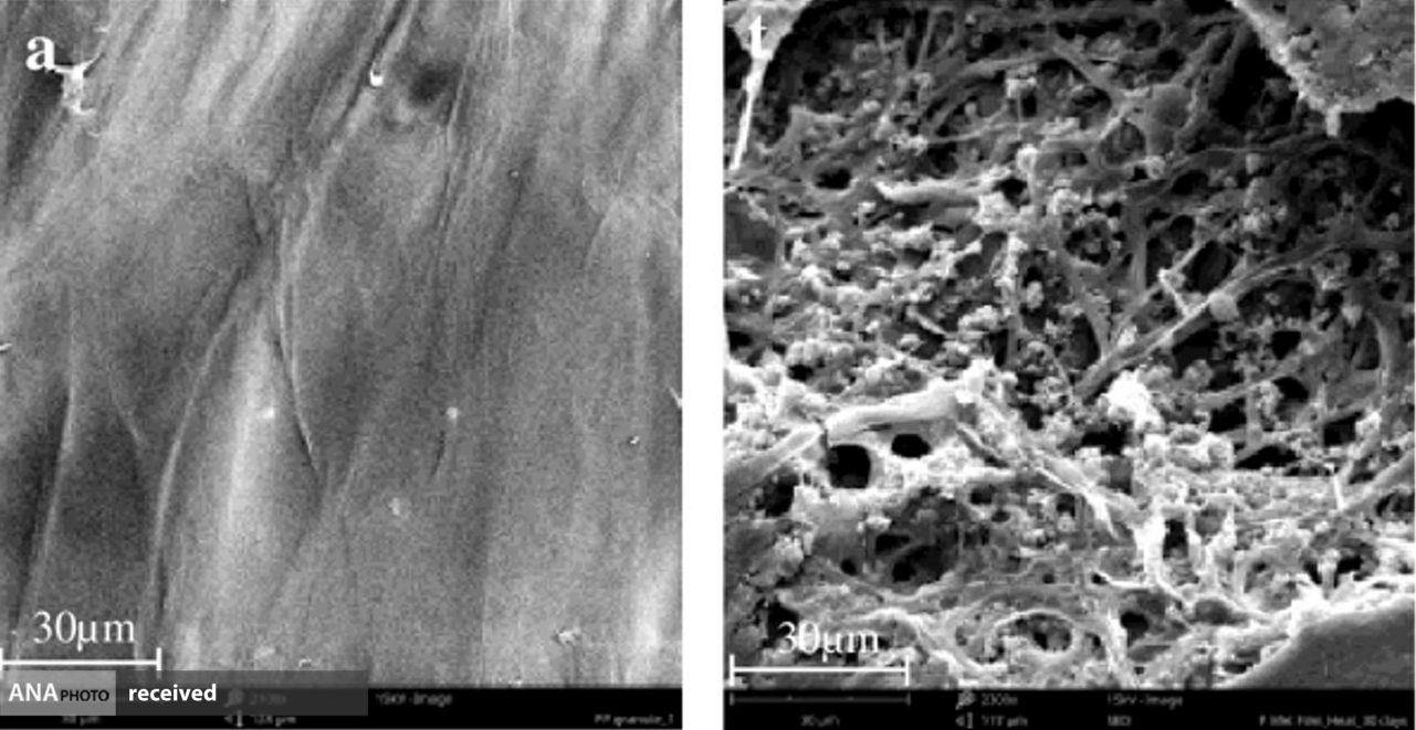 قارچهای پلاستیک خوار قاتل جان زبالهها! قارچهای پلاستیک خوار قاتل جان زبالهها!