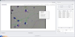 طراحی و ساخت دستگاه آنالیز اسپرم با نتایج دقیق و تکرارپذیر