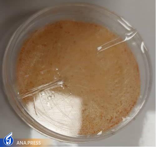 خبری خوش برای بیماران دیابتی‌/ رونمایی از محصولی دانش‌بنیان که از قطع عضو دیابتی‌ها جلوگیری می‌کند