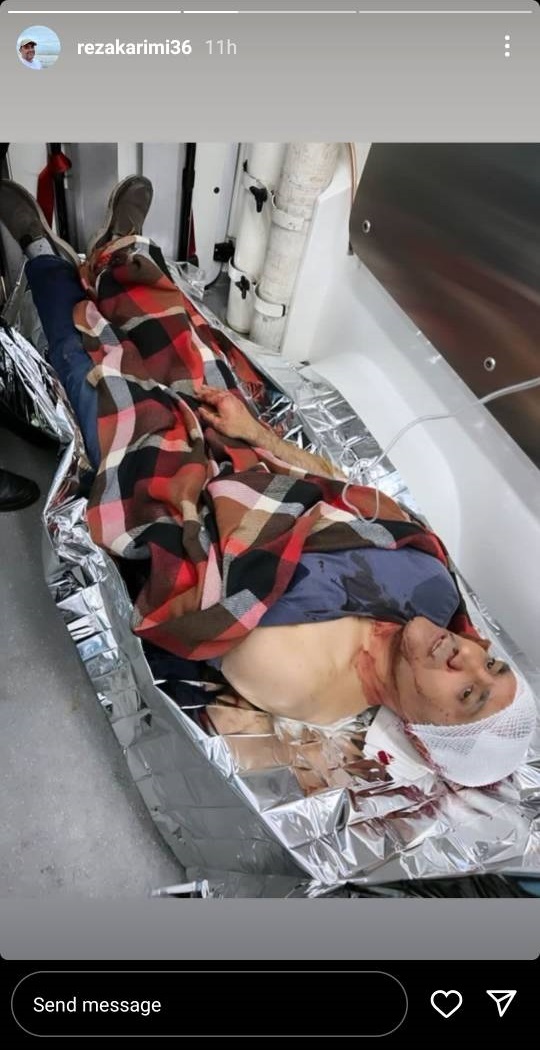 حمله گروهی اراذل و اوباش به بازیگر سینما و تلویزیون حمله گروهی اراذل و اوباش به بازیگر سینما و تلویزیون