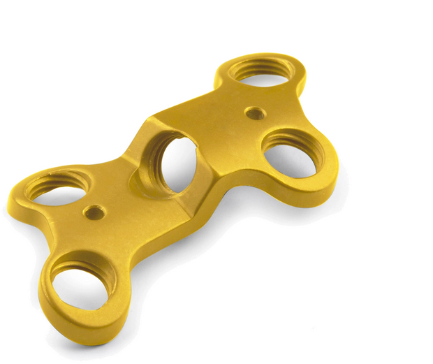 ایمپلنت‌های تخصصی برای شکستگی‌های مفاصل دست و پا بومی‌سازی شد