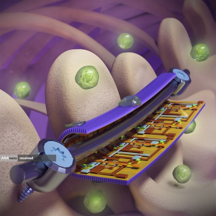 طراحی ایمپلنت جراحی ضدباکتری با الهام از بال‌های سنجاقک