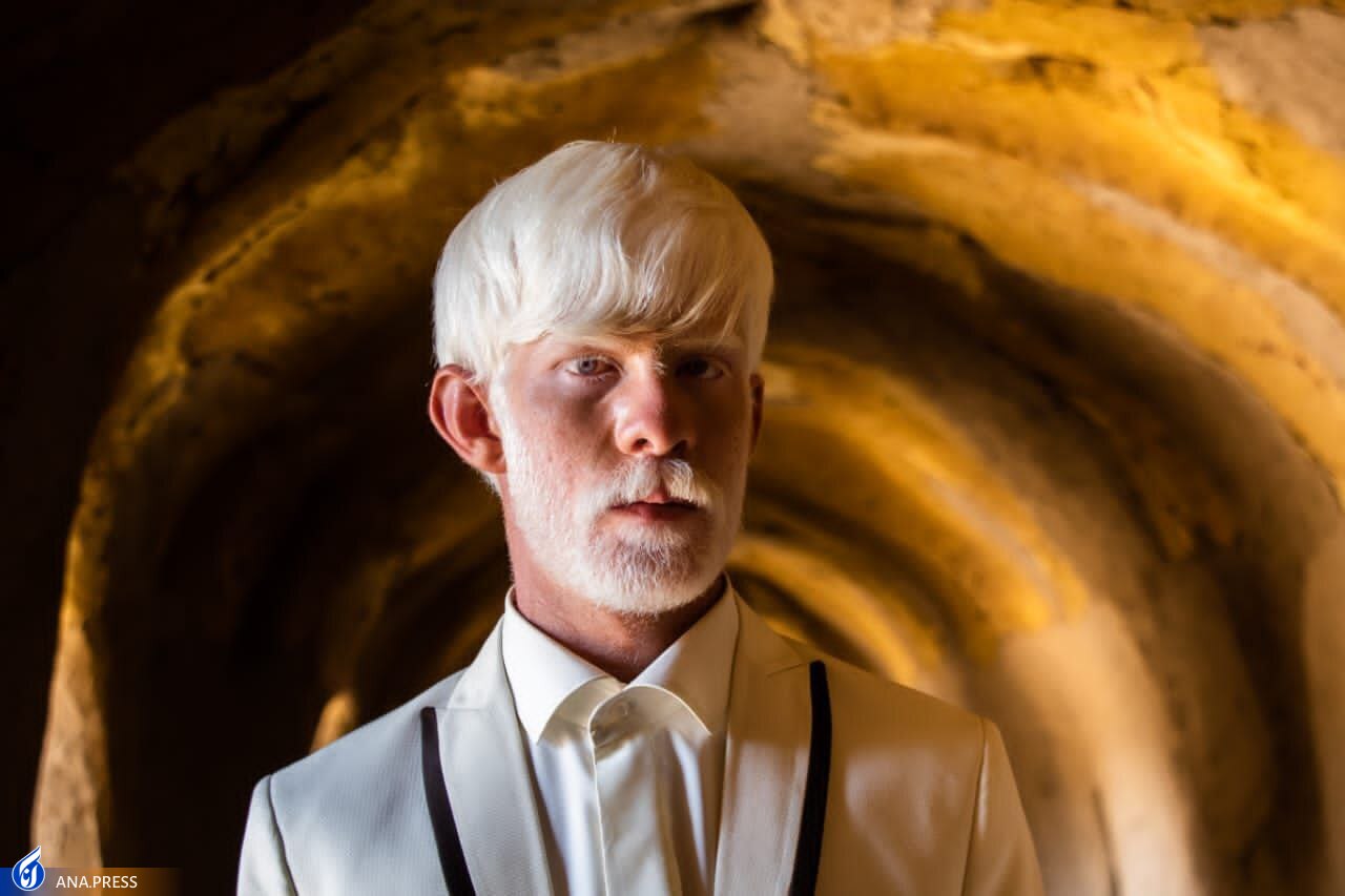 «رویای کاغذی»؛ انعکاس مشکلات آلبینیستها بر پرده نقرهای سینما «رویای کاغذی»؛ انعکاس مشکلات آلبینیستها بر پرده نقرهای سینما