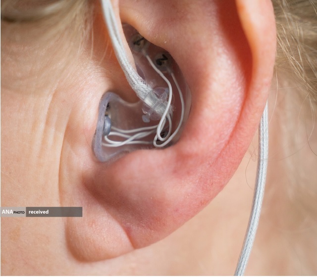 تشخیص بهموقع بیماری آلزایمر با کنترل فعالیت الکتریکی مغز تشخیص بهموقع بیماری آلزایمر با کنترل فعالیت الکتریکی مغز