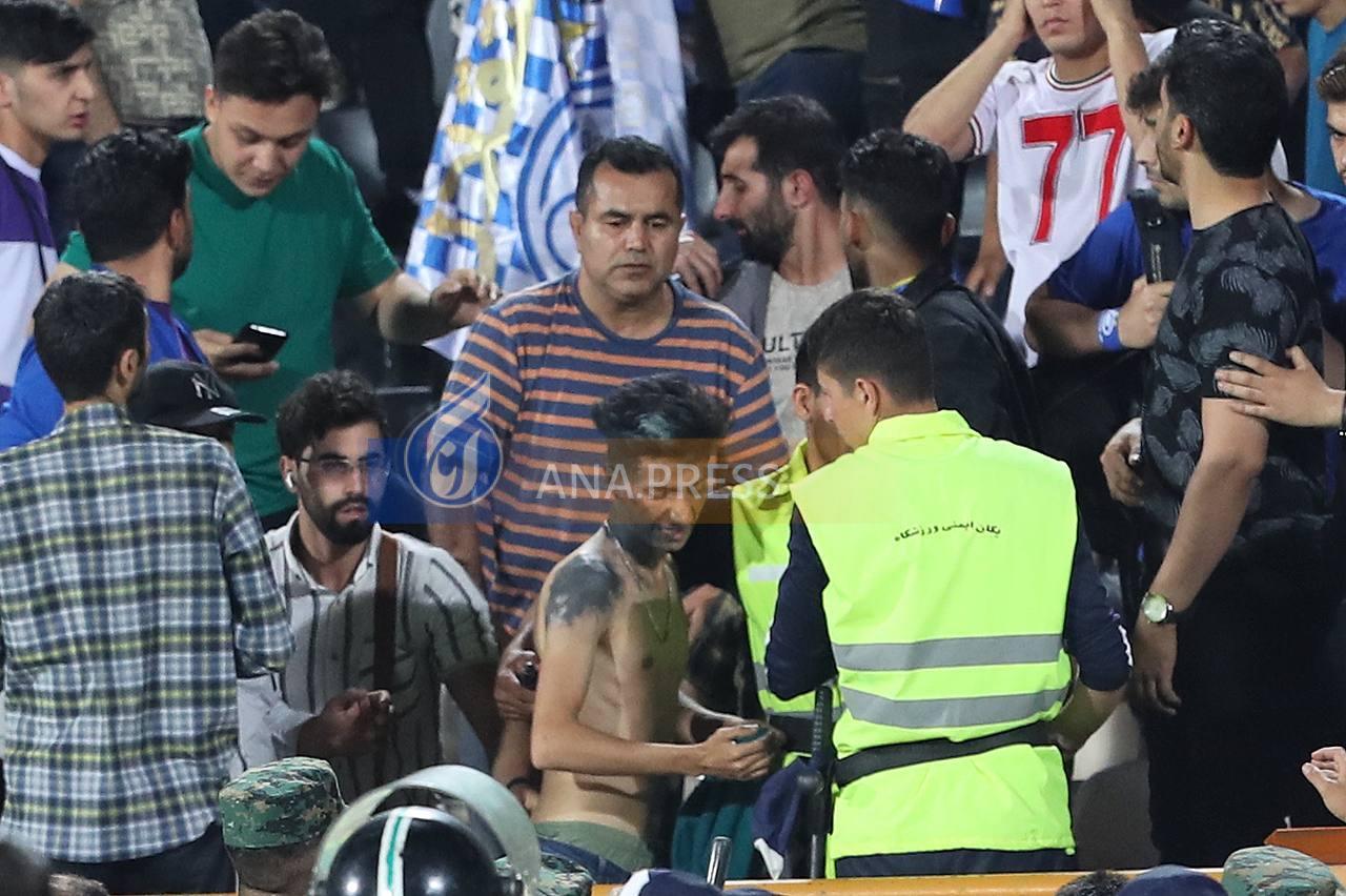صحنه‌های زشت از دربی ۱۰۱/ اصابت نارنجک به صورت هوادار استقلال+تصاویر