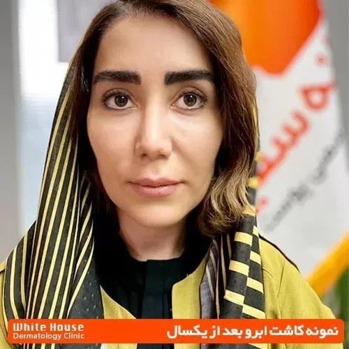 آنچه باید در مورد کاشت ابرو طبیعی و مصنوعی بدانید! آنچه باید در مورد کاشت ابرو طبیعی و مصنوعی بدانید!