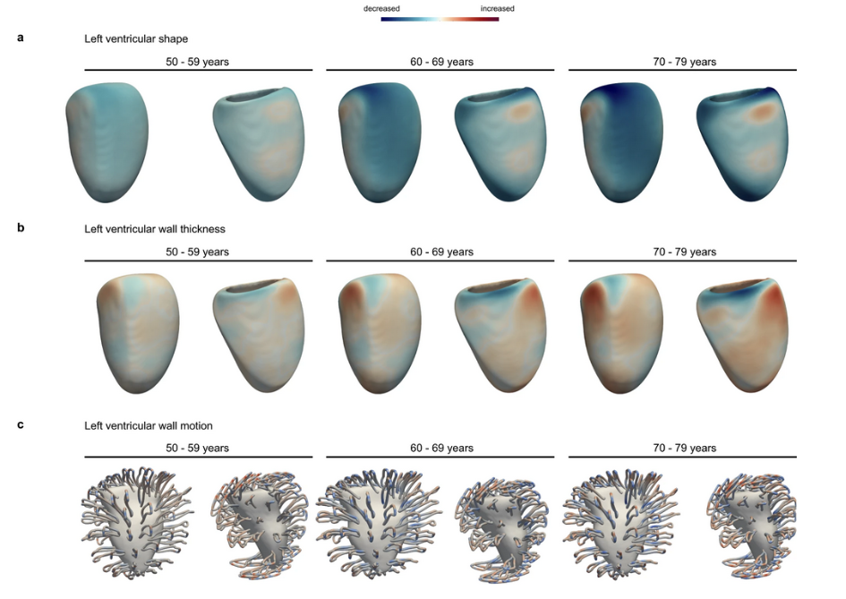 قلبتان چند سال دارد؟ پیشبینی «سن قلب» با هوش مصنوعی ممکن شد قلبتان چند سال دارد؟ پیشبینی «سن قلب» با هوش مصنوعی ممکن شد