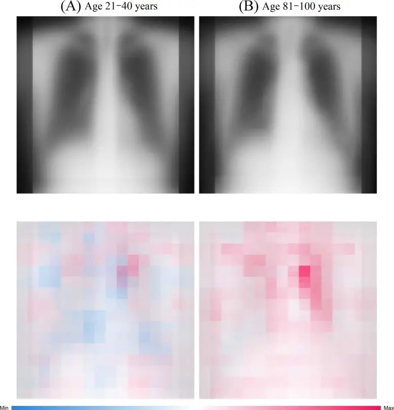 تعیین سن دقیق با بررسی قفسه سینه تعیین سن دقیق با بررسی قفسه سینه