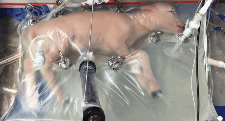 آزمایشهای بالینی رحم مصنوعی به زودی آغاز شود آزمایشهای بالینی رحم مصنوعی به زودی آغاز شود