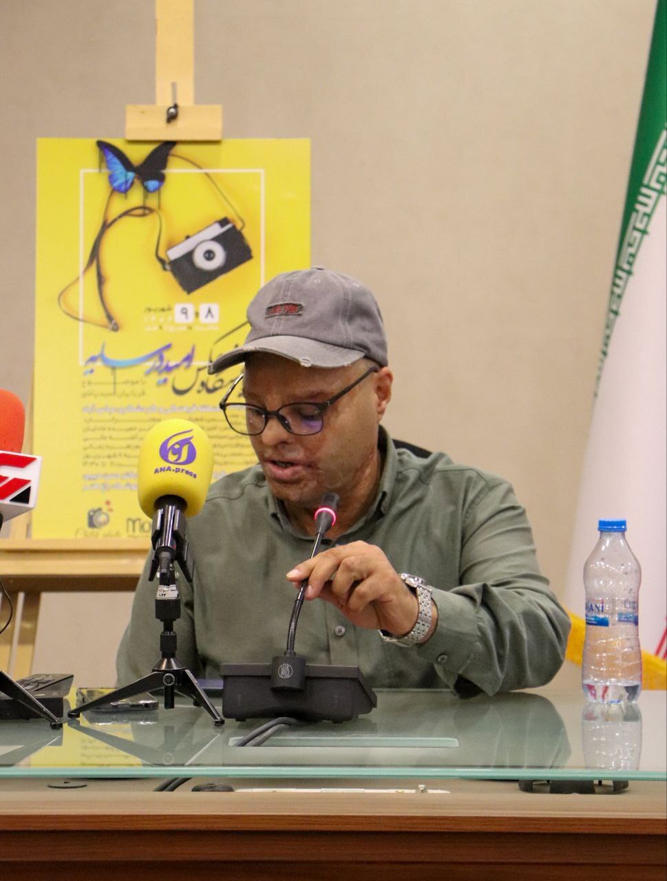 نمایشگاه عکس «امید در سایه» و نگاهی متفاوت به پدیده اسیدپاشی