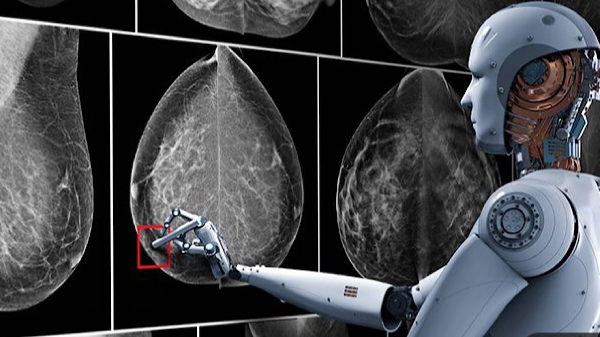غربالگری سرطان سینه با داده‌های هوش مصنوعی در ۳۰ ثانیه توسط محققان کشور