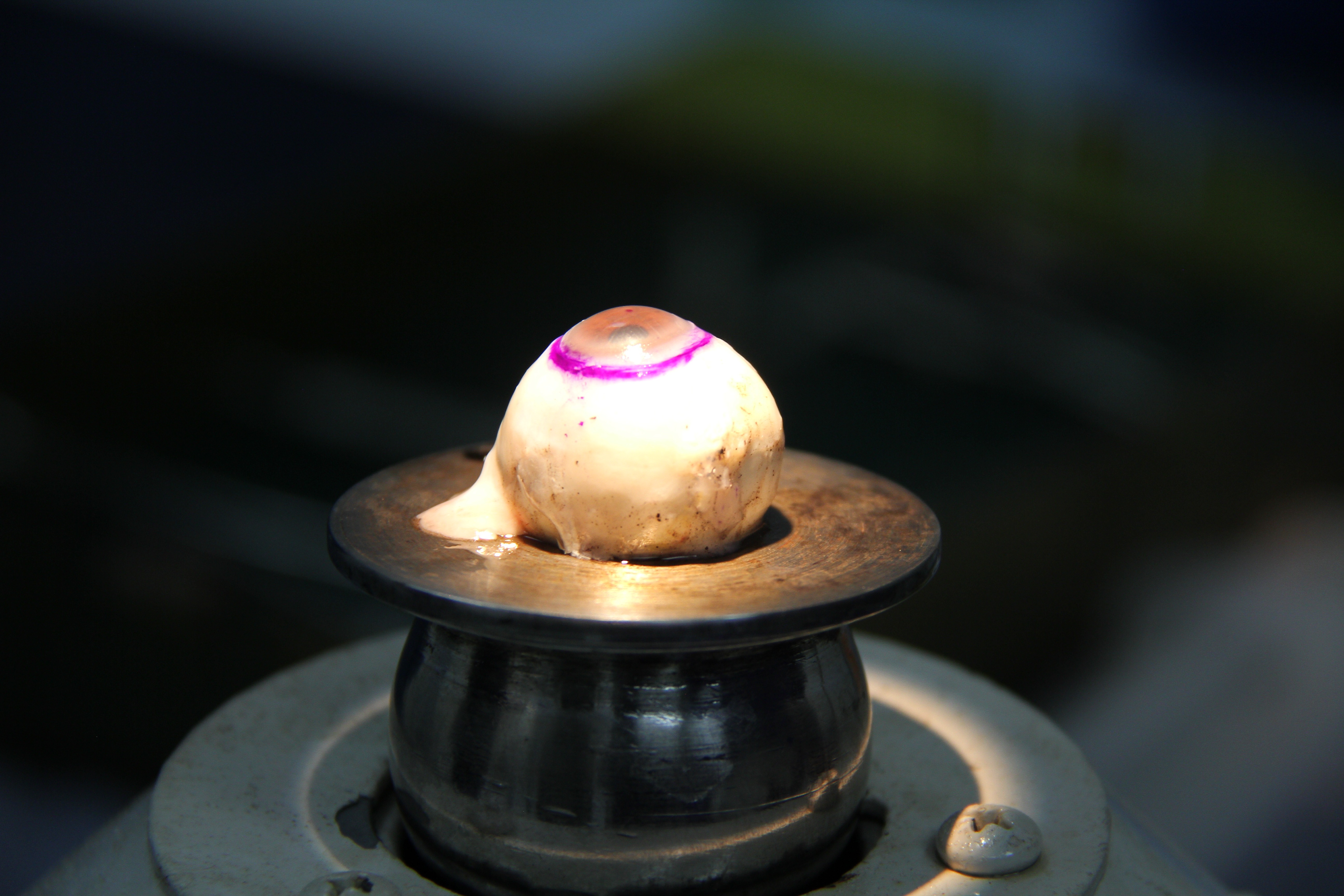 پیوند سلول های بنیادی بازساختی قرنیه؛ به کمک درمان نابینایی ناشی از سوختگی ها آمد پیوند سلول های بنیادی بازساختی قرنیه؛ به کمک درمان نابینایی ناشی از سوختگی ها آمد