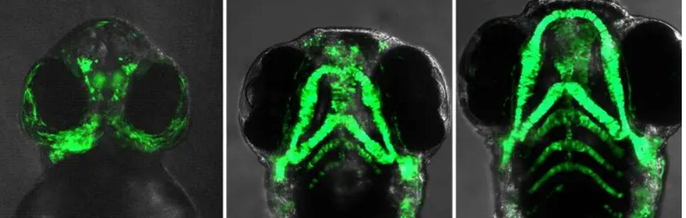 مصرف داروهایی که رشد صورت جنین را مختل میکند مصرف داروهایی که رشد صورت جنین را مختل میکند