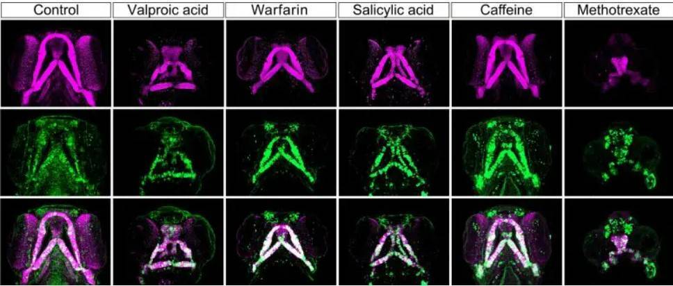 مصرف دارو‌هایی که رشد صورت جنین را مختل می‌کند 