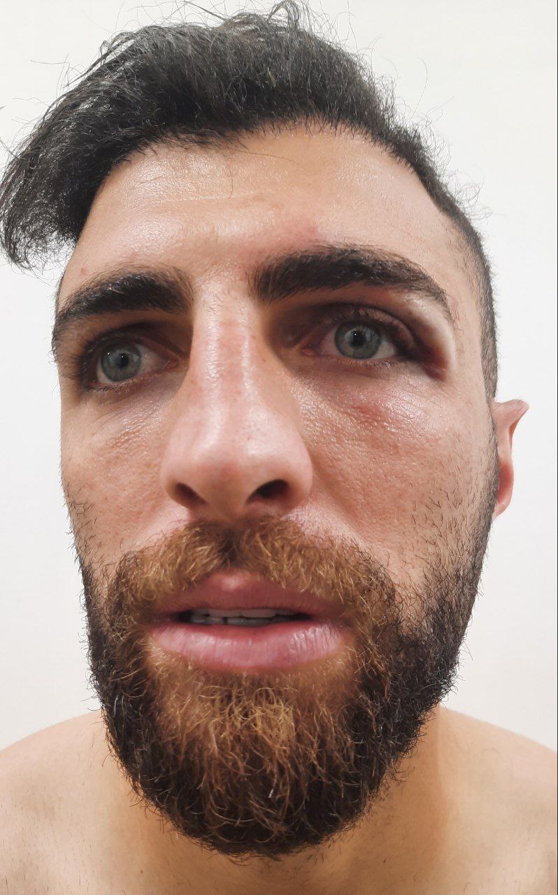 تصویری از مصدومیت میثم تیموری در دیدار با فولاد تصویری از مصدومیت میثم تیموری در دیدار با فولاد