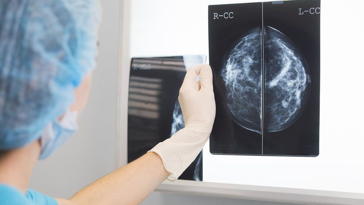 هوش مصنوعی سرطان سینه را دقیق‌تر از پزشکان تشخیص می‌دهد