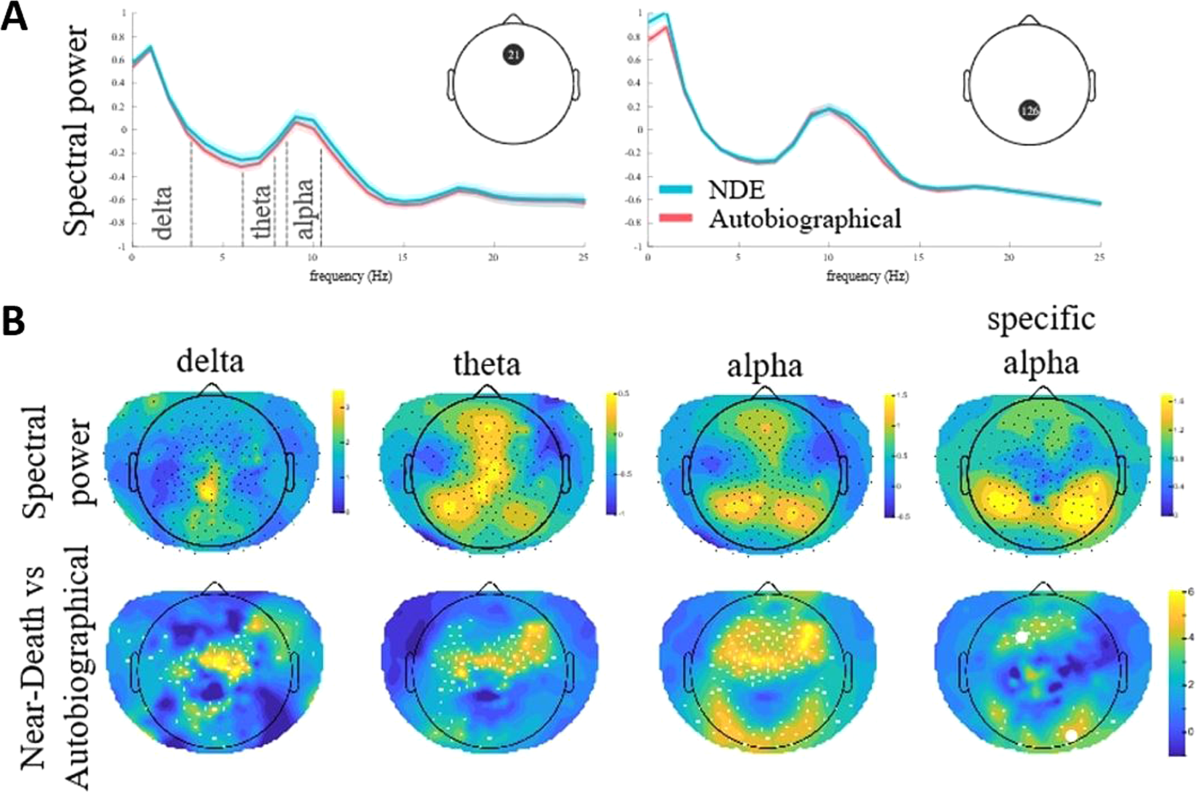 اسرار نوروبیولوژیک «تجربه نزدیک‌به‌مرگ»