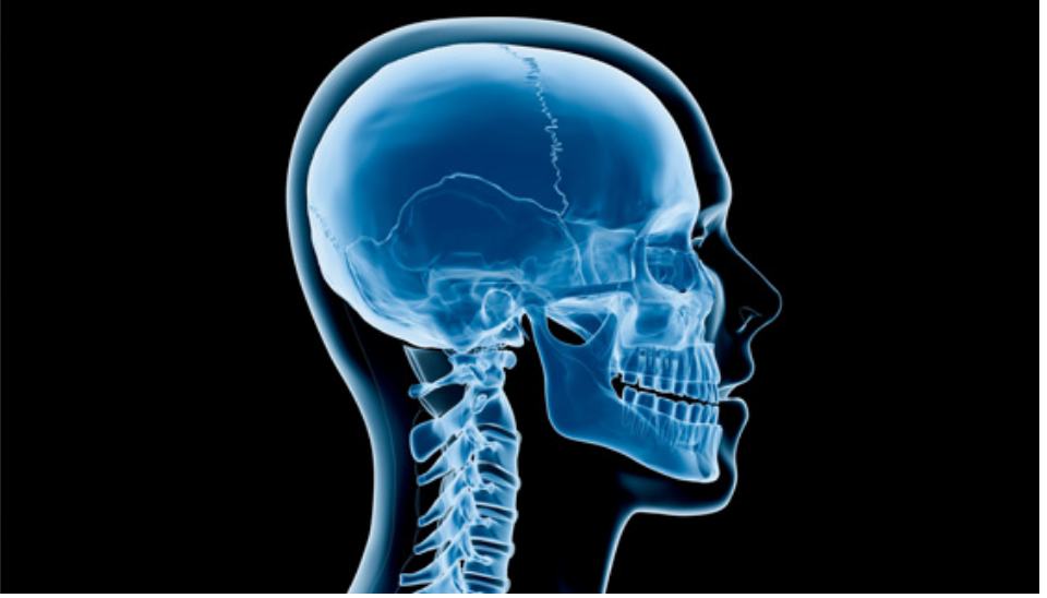 منبع نور اشعه ایکس چیست؟