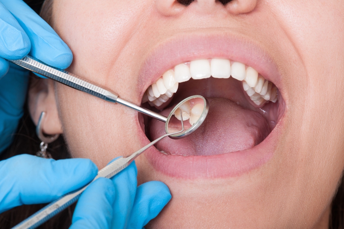 سلامت دهان و دندان در بیماران کلیوی