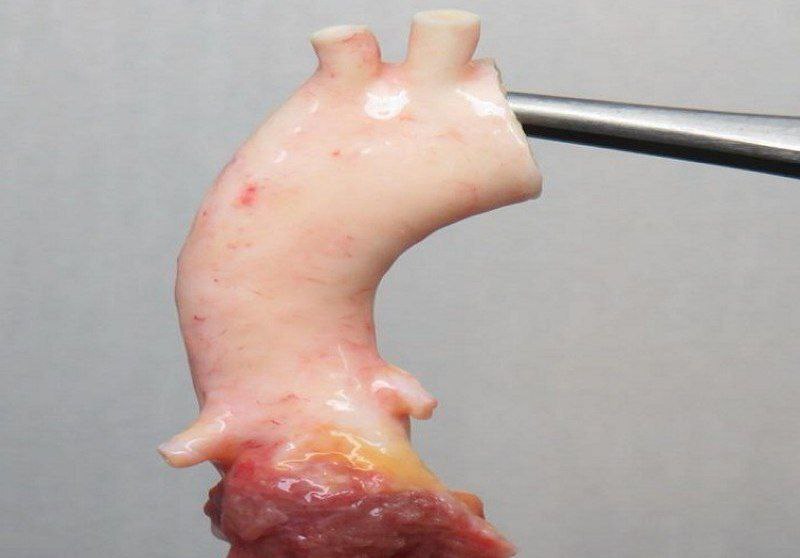 پیشرفت آلوگرافت با منشا انسانی در گروی اهدای جسد پیشرفت آلوگرافت با منشا انسانی در گروی اهدای جسد