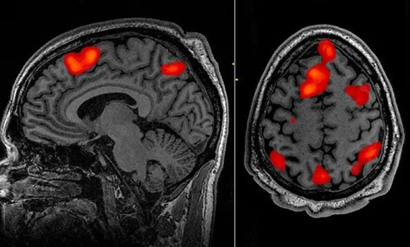 تبدیل افکار خاموش ذهن به گفتار| ابزاری که اندیشه را واژه می‌کند!
