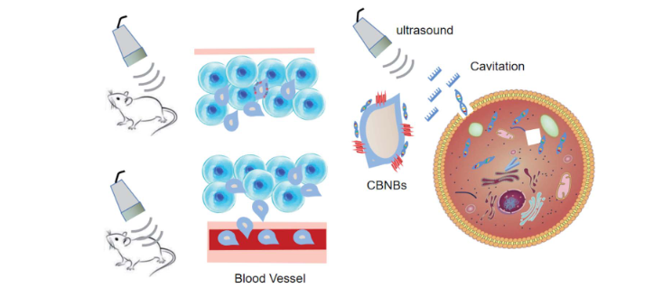 استفاده از نانو حباب برای درمان هدفمند سرطان