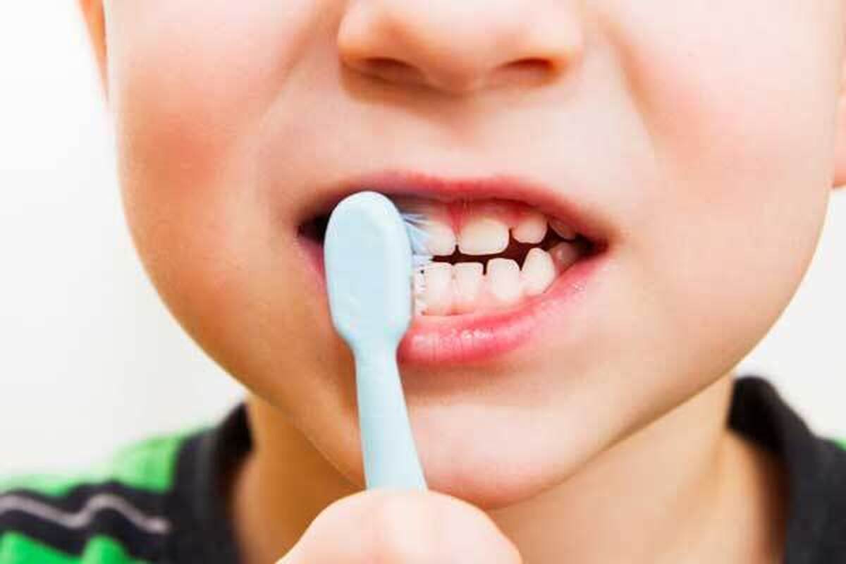 افتادن زودهنگام دندان‌ شیری عامل ناهنجاری‌های دندانی‌/ قطره آهن عامل پوسیدگی دندان نیست