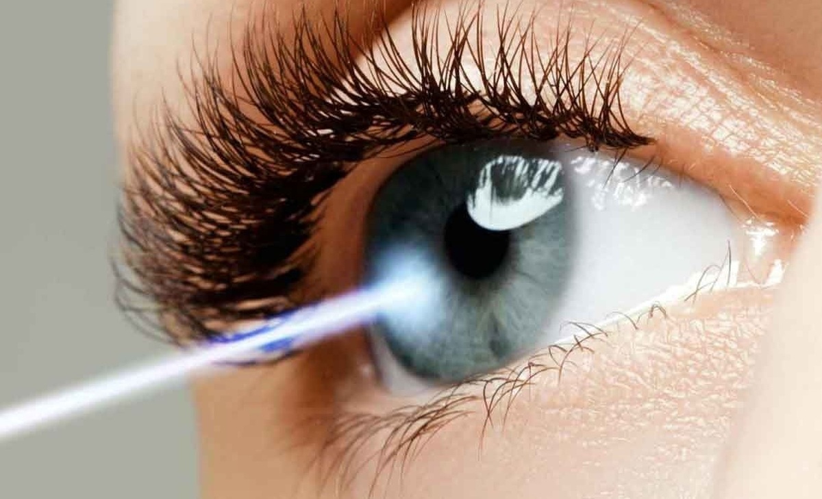 برخی مراکز تخصصی چشم‌پزشکی به جای درمان، کار زیبایی می‌کنند  تبلیغ عمل لیزیک در فضای مجازی بازی با سلامت مردم است
