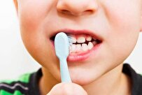 افتادن زودهنگام دندان‌ شیری عامل ناهنجاری‌های دندانی‌/ قطره آهن عامل پوسیدگی دندان نیست