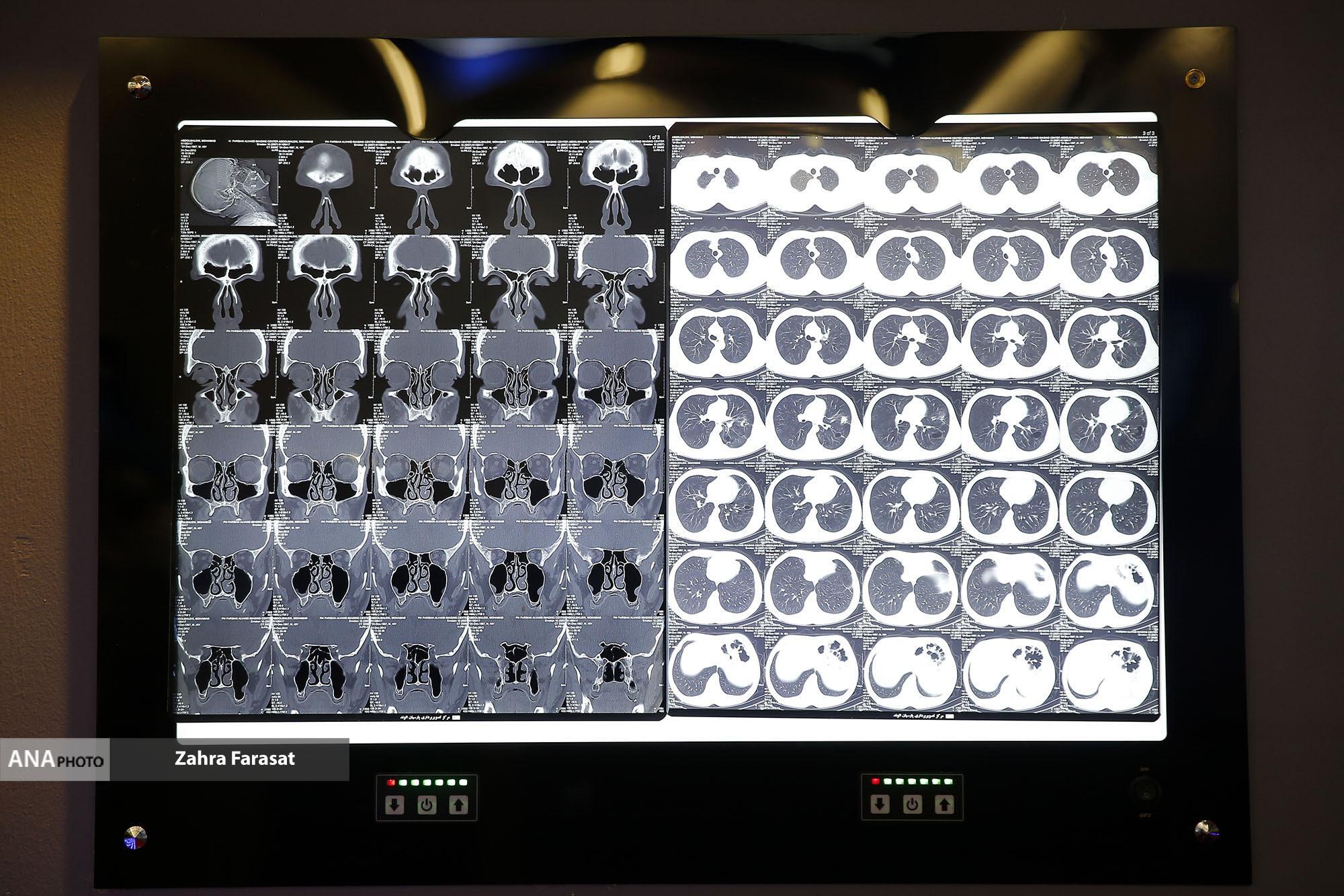 معرفی چند دستاورد‌های پزشکی/فناوری‌های سلامت‌محور چه چالش‌هایی دارند؟