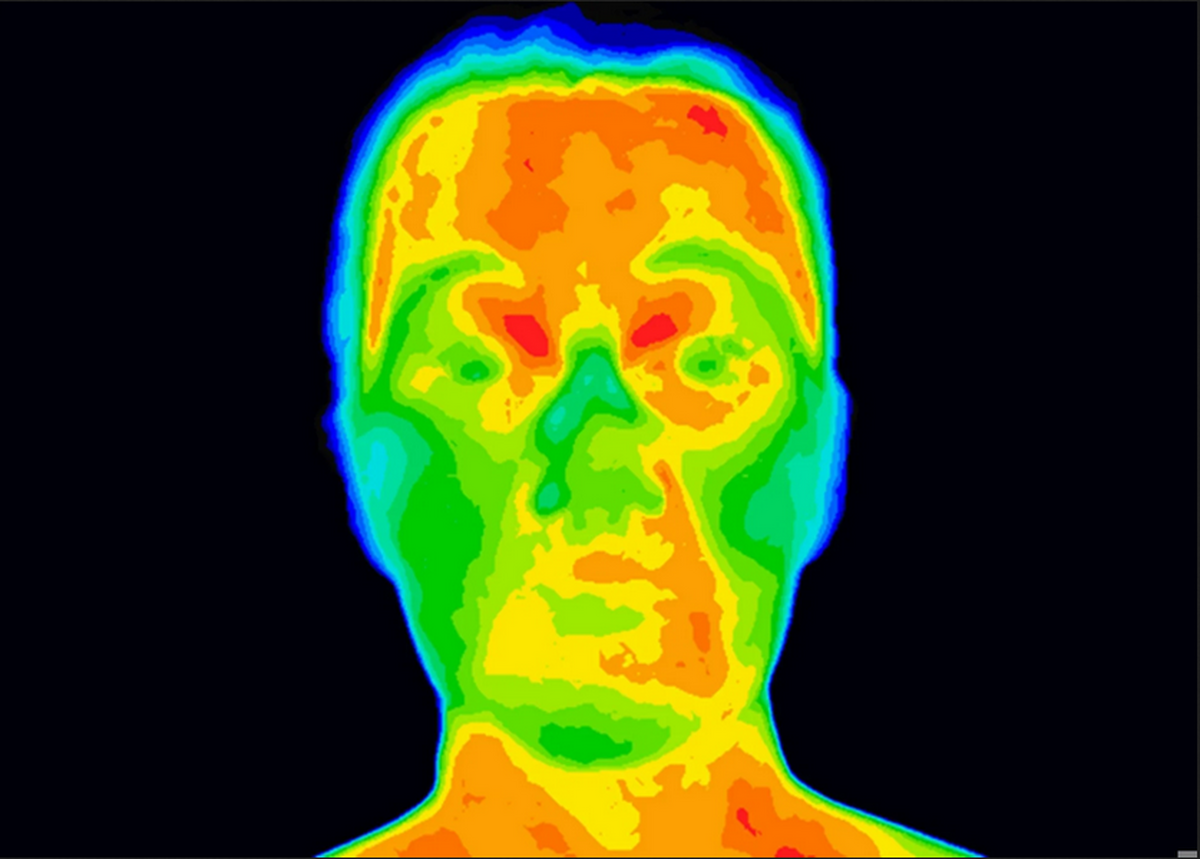 تشخیص بیماری‌‌ از دمای صورت  هوش مصنوعی الگوهای حرارتی بدن را کشف کرد