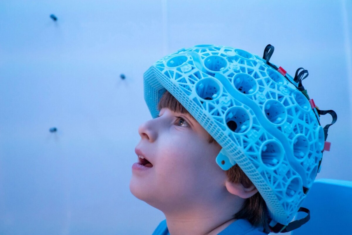 تهیه دقیق‌ترین تصویر از مغز کودکان با فناوری اسکنر پوشیدنی