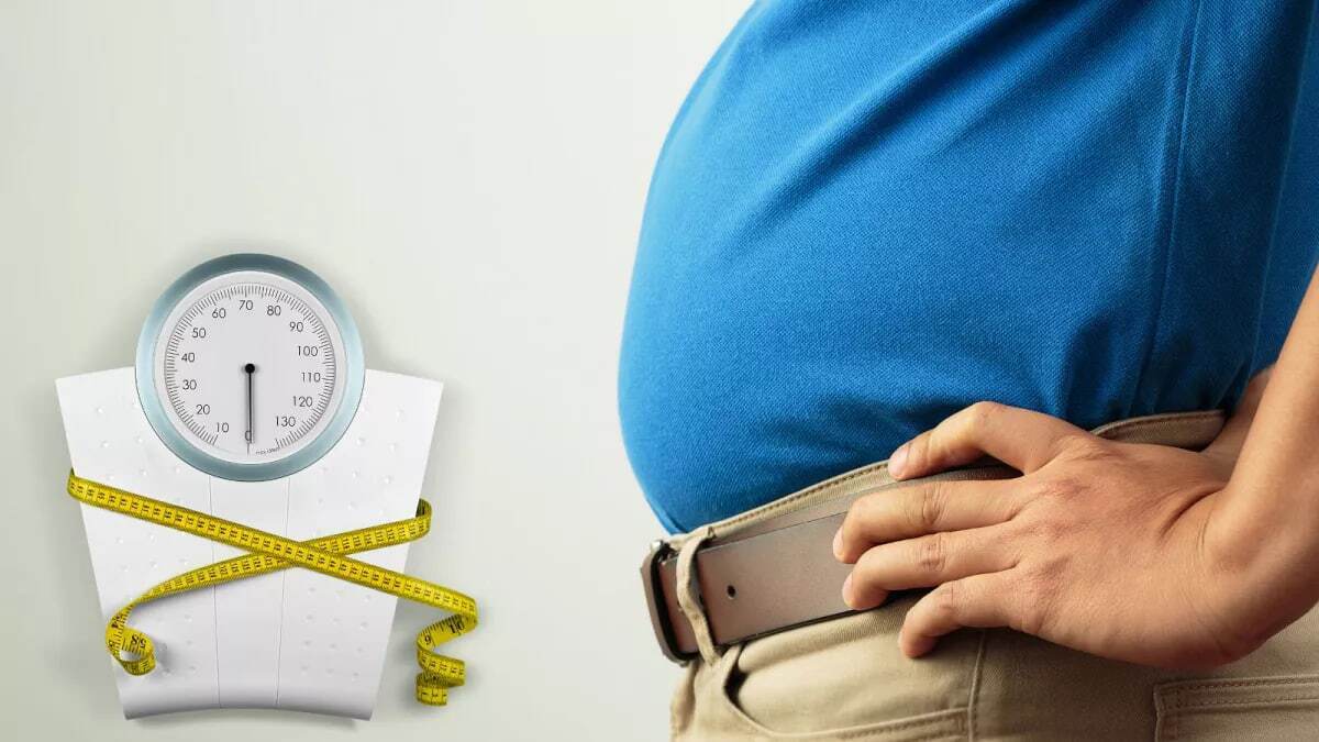 چاقی ۲۵ درصد جمعیت کشور/ جراحی چاقی یک عمل درمانی است