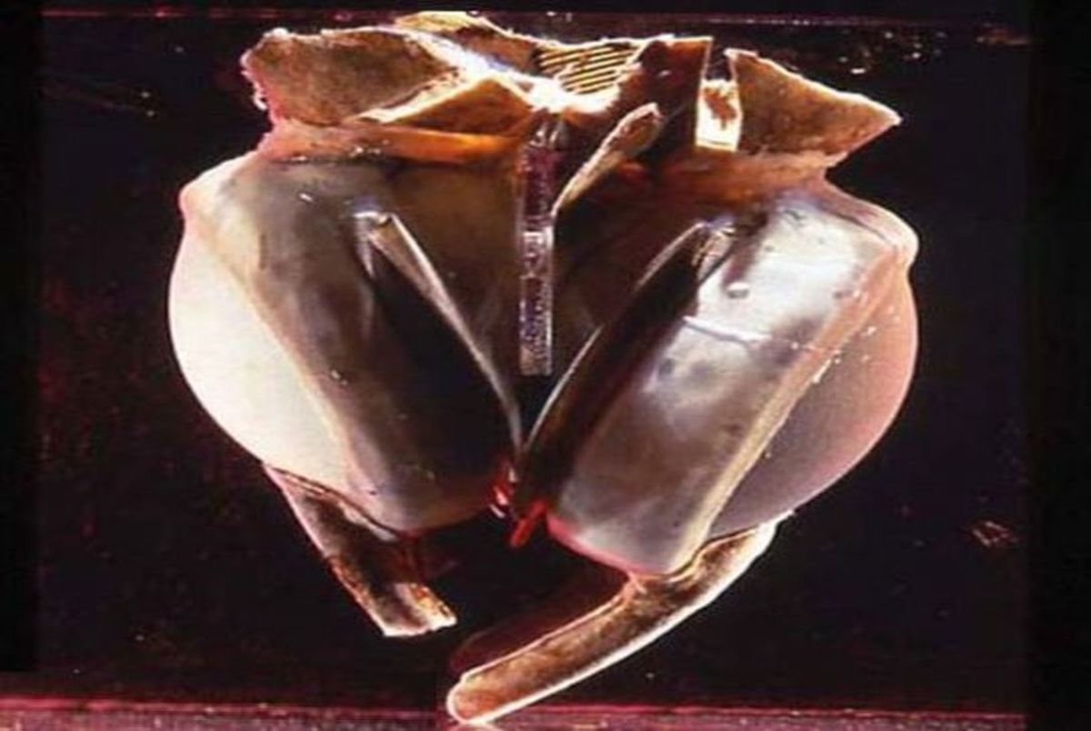 فناوری پزشکی به سمت تکامل؛ قلب‌های تیتانومی جایگزین قلب‌های پیوندی از مرگ مغزی می‌شوند؟