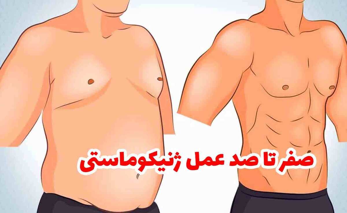 صفر تا صد عمل ژنیکوماستی، از فرآیند تا هزینه، ماندگاری و مراقبت‌ها