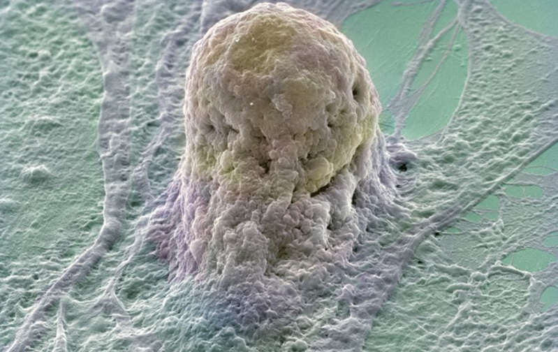 سلول‌های بنیادی، تجارت و پرتگاه اخلاق یا نجات و رویای شفا