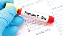 گسترش خدمات تشخیص و درمان هپاتیت C اولویت نظام سلامت کشور است