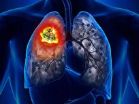 سیگار و قلیان عامل ۸۰ تا ۹۰ درصد مرگ‌ومیر ناشی از سرطان ریه