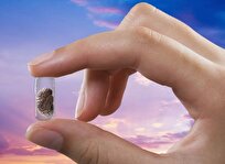 مغزهای انسانی با ابعاد کنجدی